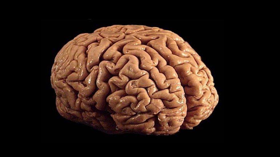 Bilim dünyasında flaş gelişme. Beynin gizemi çözülüyor!